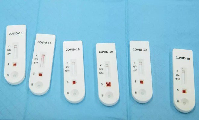 Informace pro zaměstnavatele a zaměstnance ohledně povinného testování ve firmách případně samotest 2.jpg