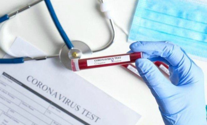 Neschopenka může současně být žádankou na testování a na žádost hygien 2.jpg