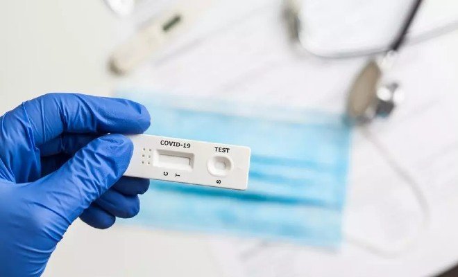 Povinné testování ve firmách už od třetího a pátého března a pojišťovny na n 2.jpg