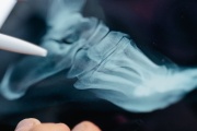 Důkazy k nemoci z povolání musí nejednou soudu doložit zaměstnanec